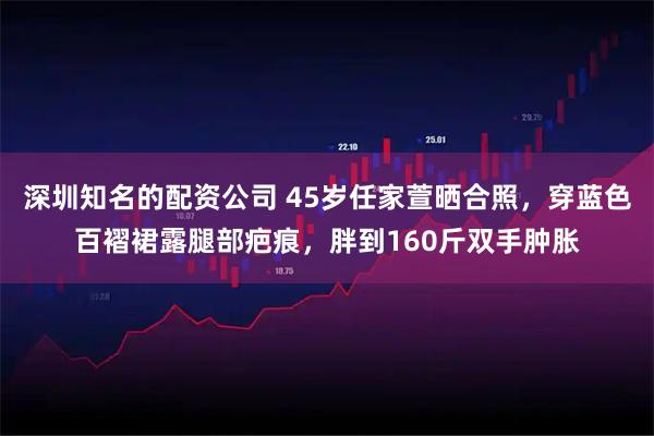 深圳知名的配资公司 45岁任家萱晒合照，穿蓝色百褶裙露腿部疤痕，胖到160斤双手肿胀